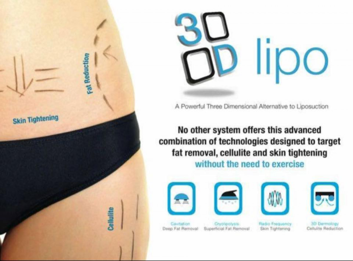 Radiance Clinic 3D Lipo Ultimate Body Sculpting Folkestone, Kent